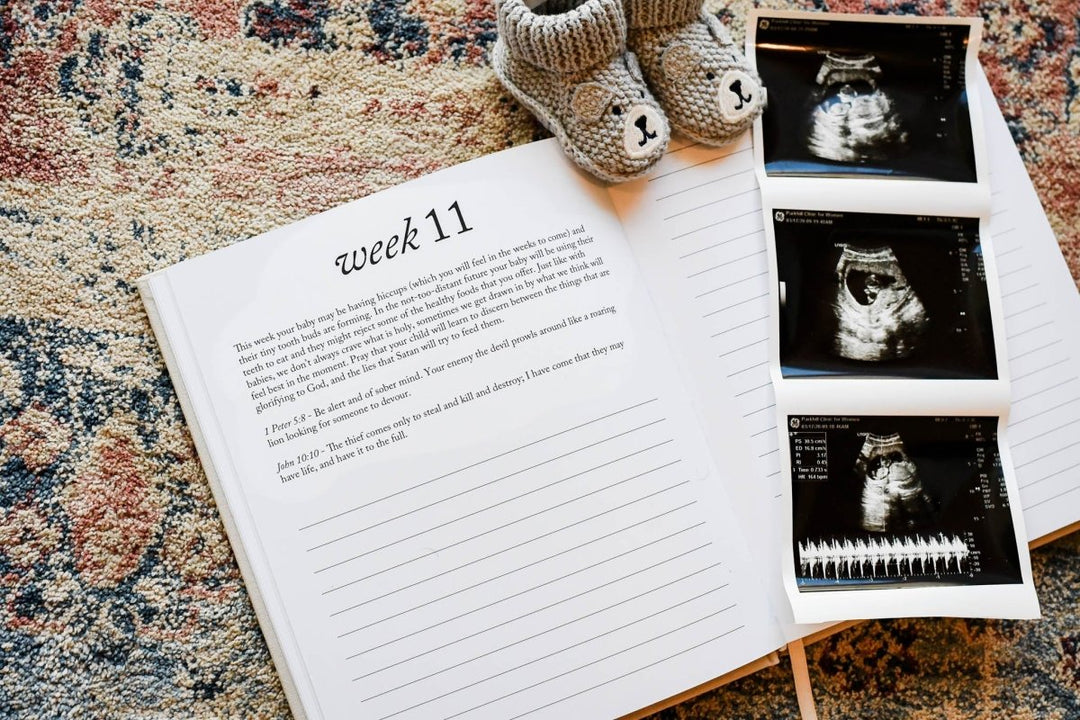 Dear Baby: Pregnancy Prayer Journal - Chicaboo