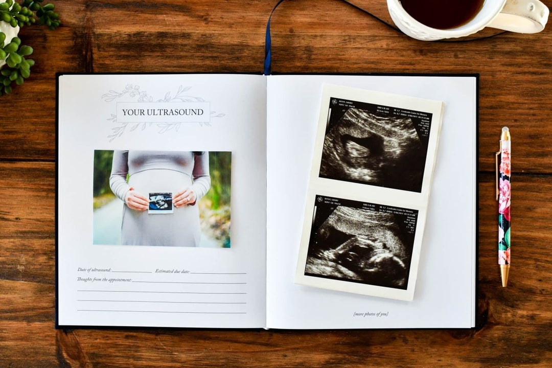 Dear Baby: Pregnancy Prayer Journal - Chicaboo